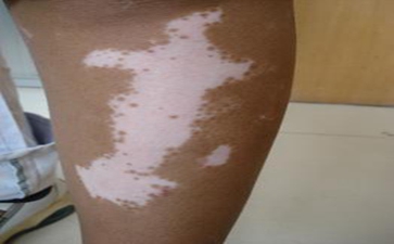 �ϰ���Ĳ�������Щ