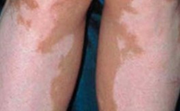 ��Щ��ȺӦ��������