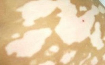 ����������˵�Σ��