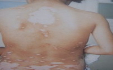 ��������֢״��ʲô