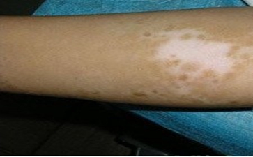 ��α��������ڱ���